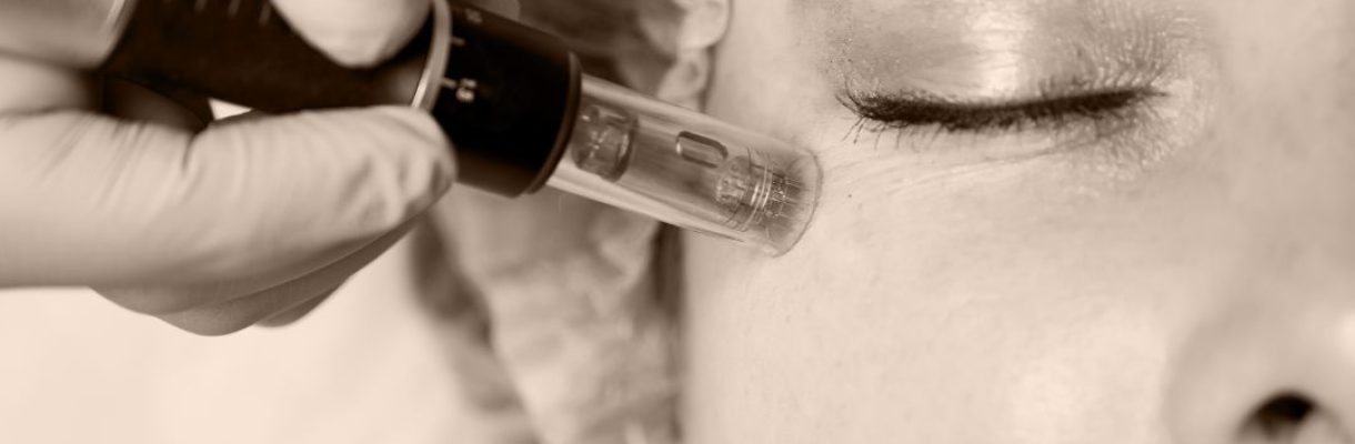 Limpieza Facial Profunda + Hidratación con Dermapen Limpieza Facial Profunda + Hidratación con Dermapen